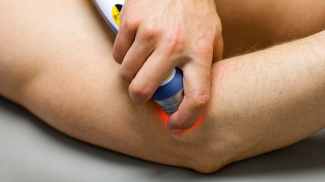 Laser Therapy